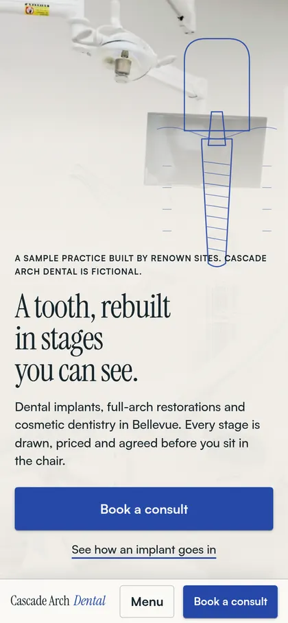 Cascade Arch Dental homepage on a phone